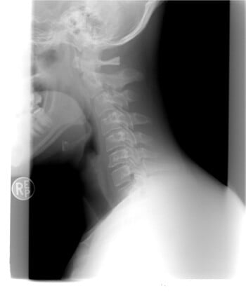 Neck X-ray