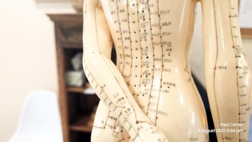 Acupuncture Pain Relief Treatment Hervey Bay