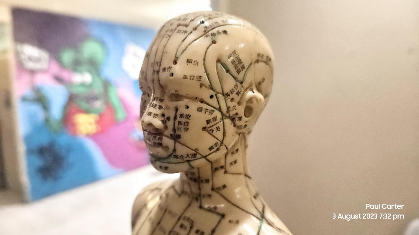 Acupuncture for Headache hervey bay