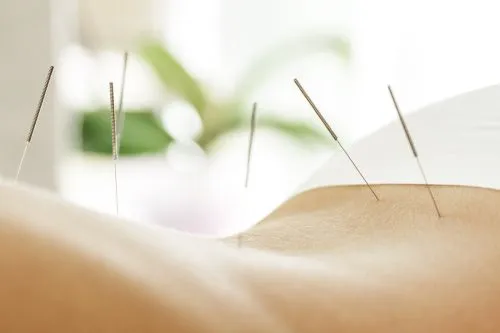 Acupuncture Lower Back Pain Research