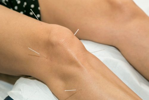 Knee pain Treatment Hervey Bay