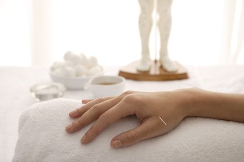 Acupuncture treatment at Li4