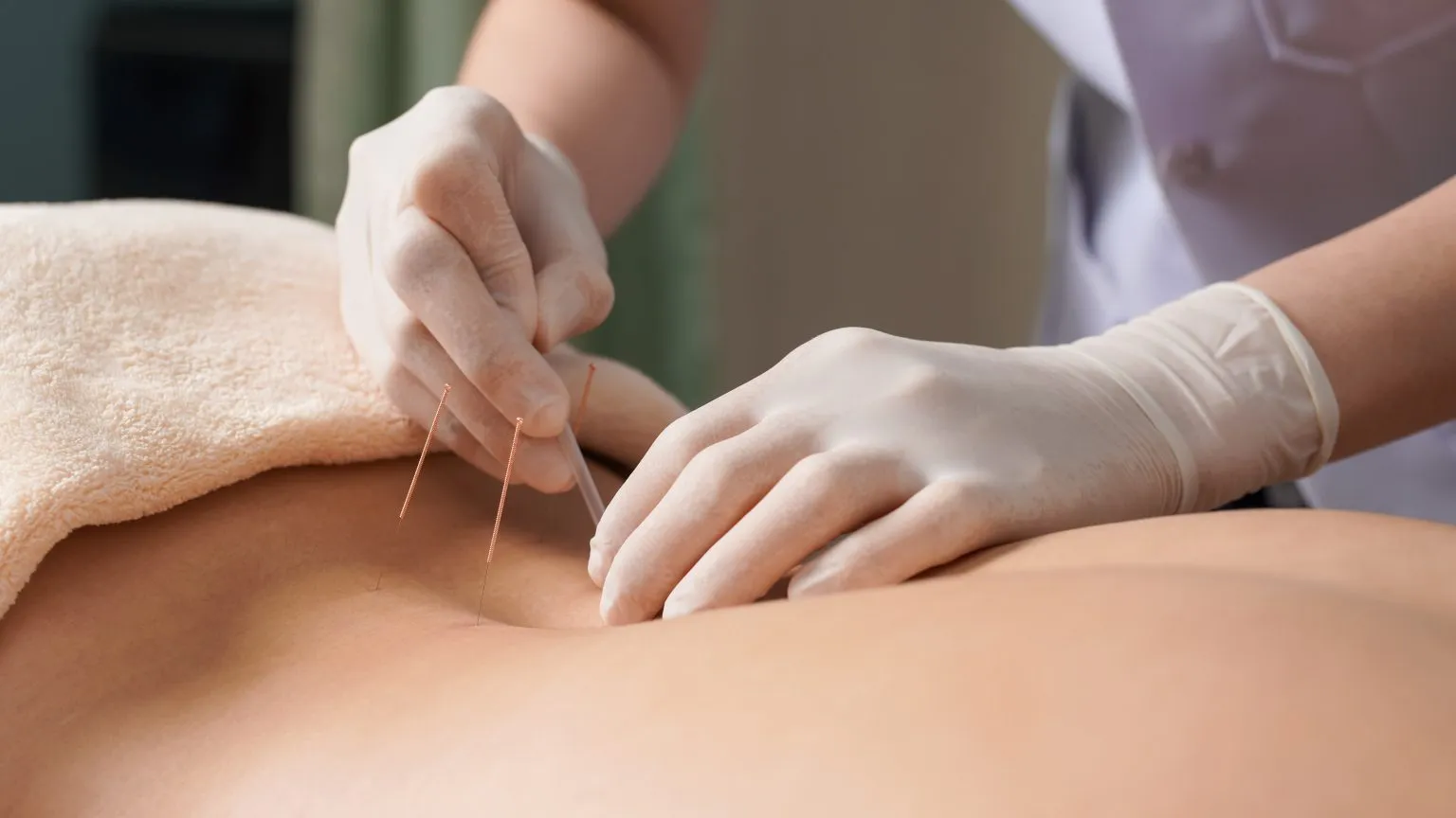 Acupuncture Emergency Department