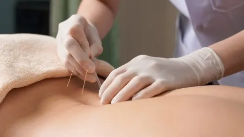 Acupuncture Emergency Department