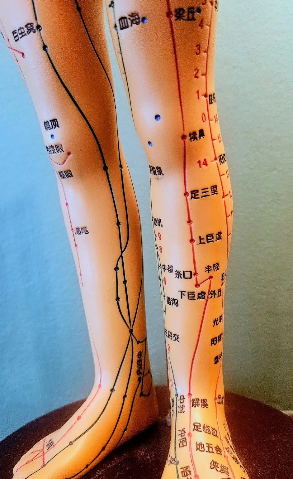 Shin Splints Acupuncture Point Model in Hervey Bay